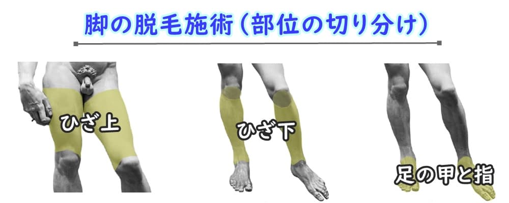 　スネ毛脱毛（レーザー脱毛施術）で知っておくべきこと


