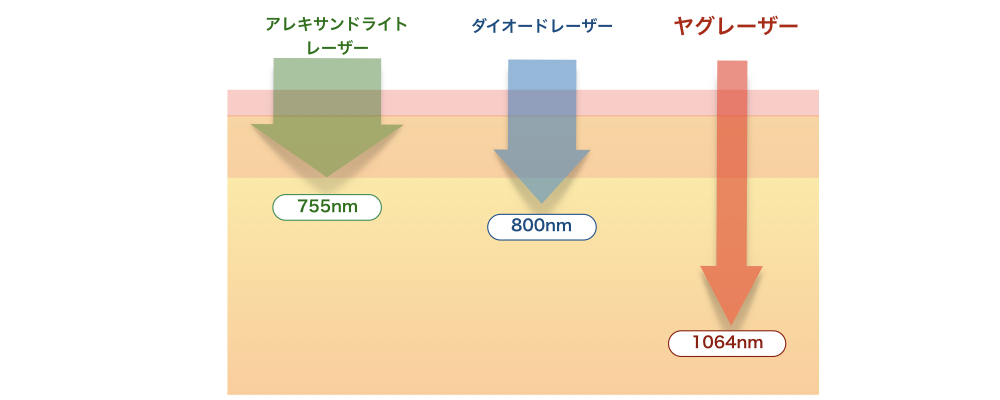 波長が長いほど皮膚深達度が増す

