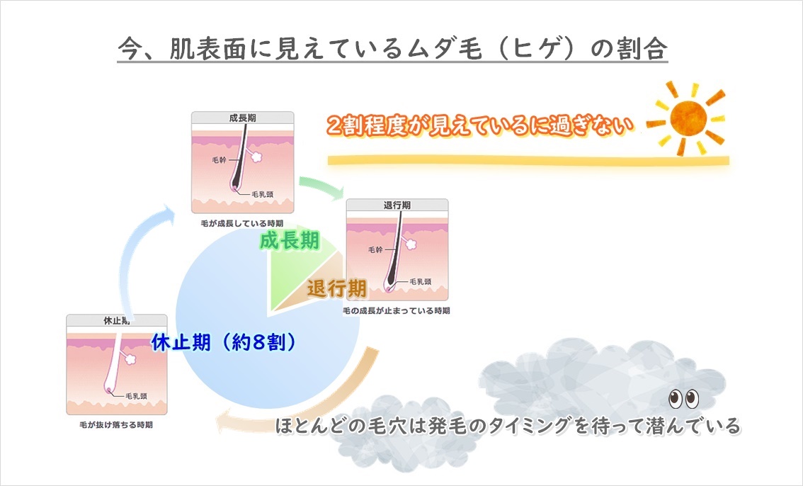 １回で退治できるムダ毛（ヒゲ）は２割が限度？