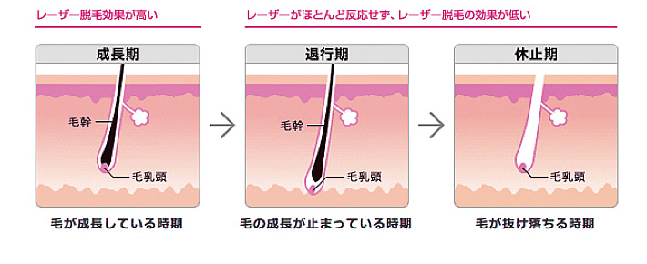 毛周期（もうしゅうき）の3サイクルと脱毛効果